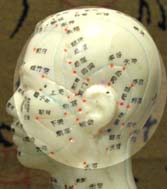 Left side of head pain location