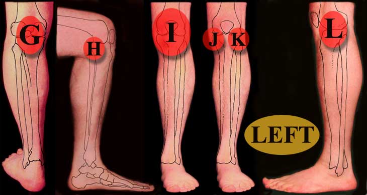 Left Knee Pain Locations