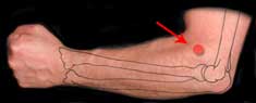 LI-11 is located on the outside of the left elbow
