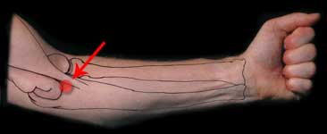 Locate PC3 acupressure point on inside of right arm