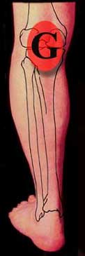 Pain location behind left knee