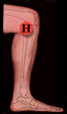 Location of knee pain on the inside of the leg